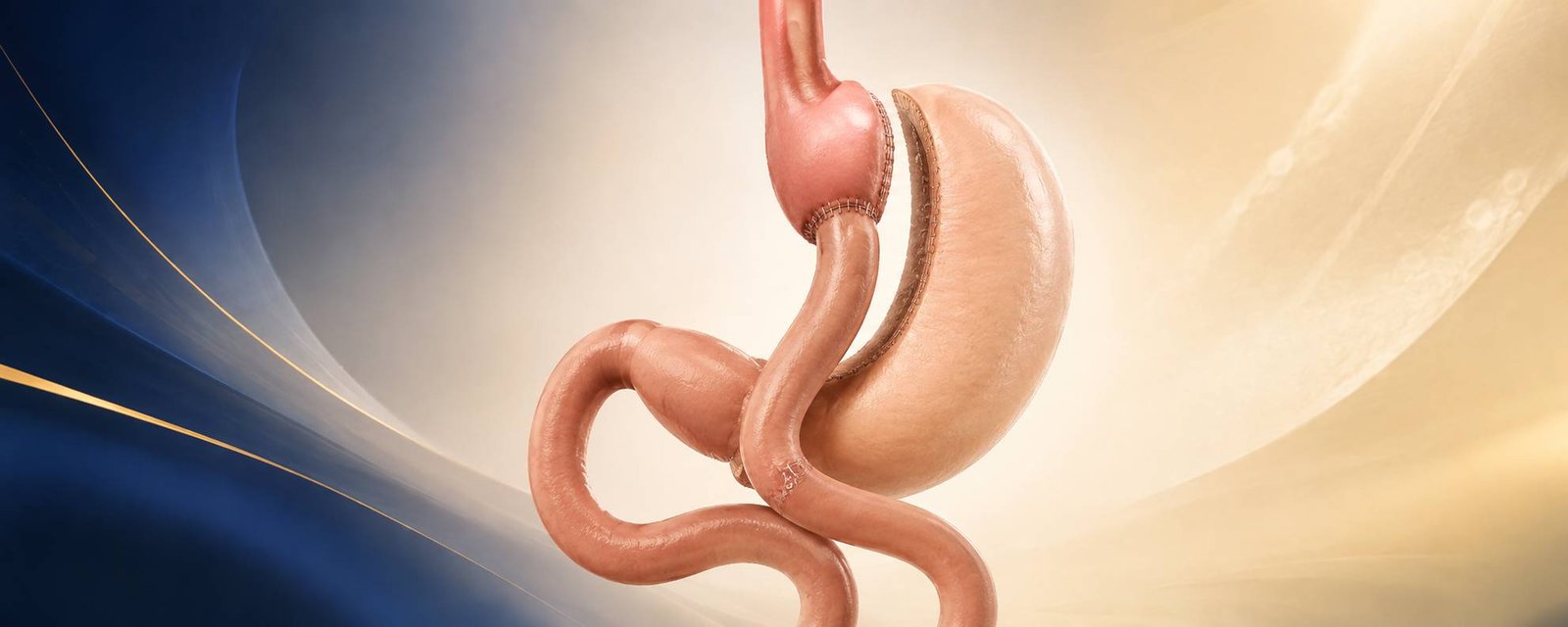 Dr.LuisCevallos_MangaGastrica